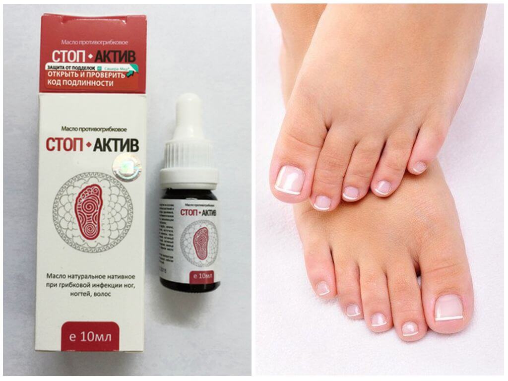 Стоп Актив от грибка ногтей