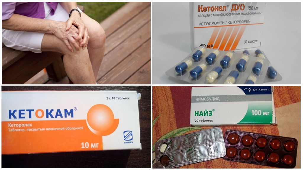 Препараты от боли при артрозе коленного сустава