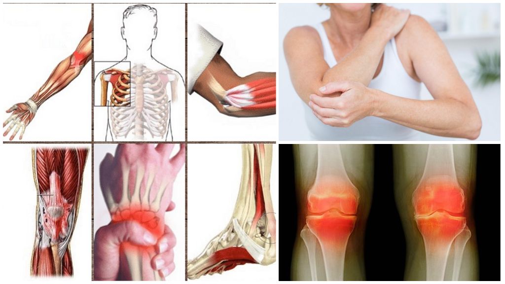 Локализация