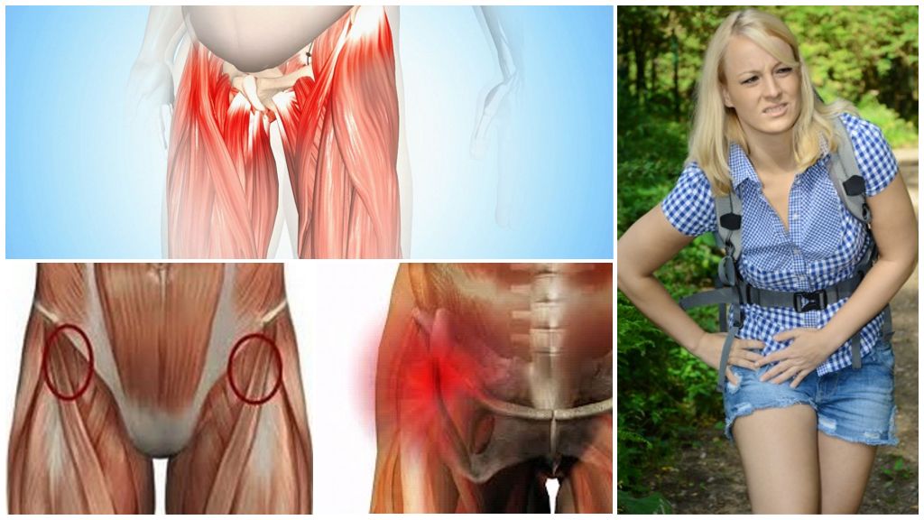 Тендинит тазобедренного сустава