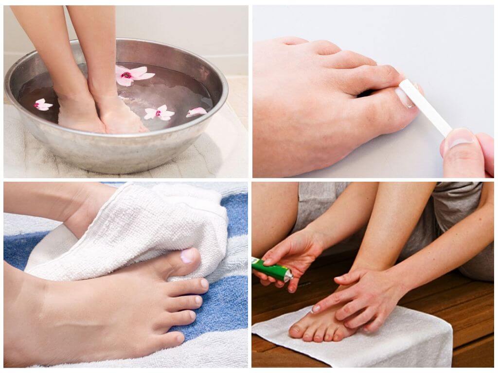 Правила использования Тербинафина