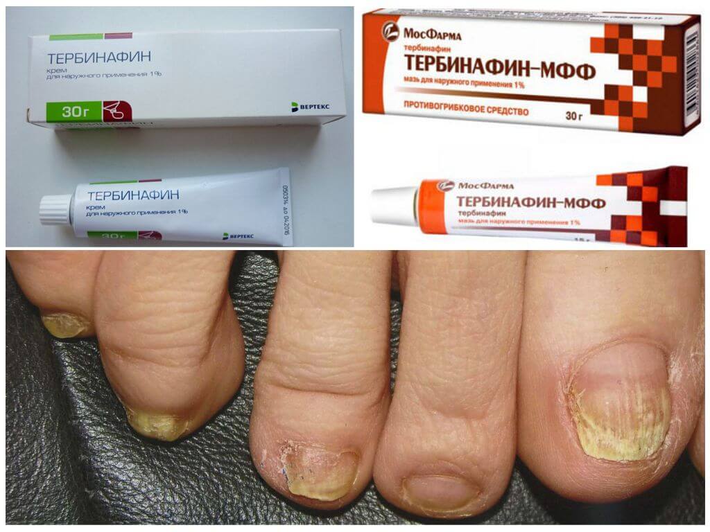 Средства для наружного применения Тербинафин
