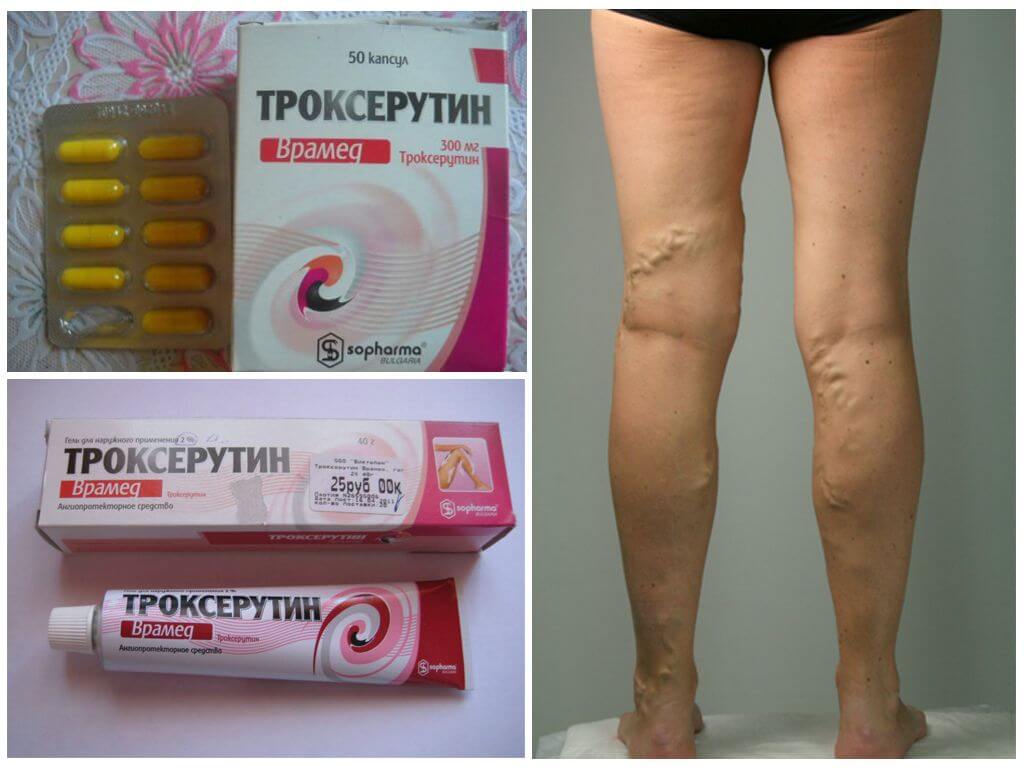 Троксерутин от варикозной болезни вен на ногах
