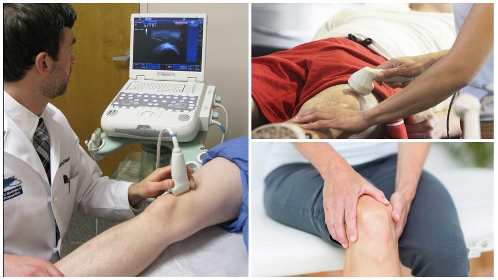 УЗИ коленного сустава
