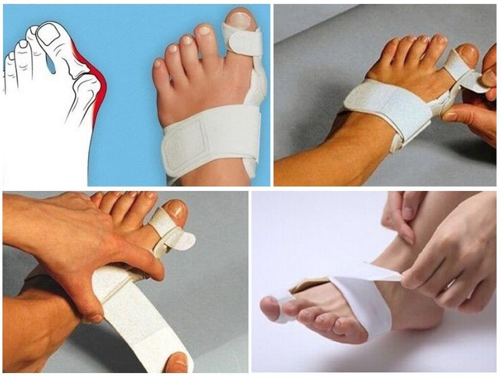 Применение фиксатора Валюфикс