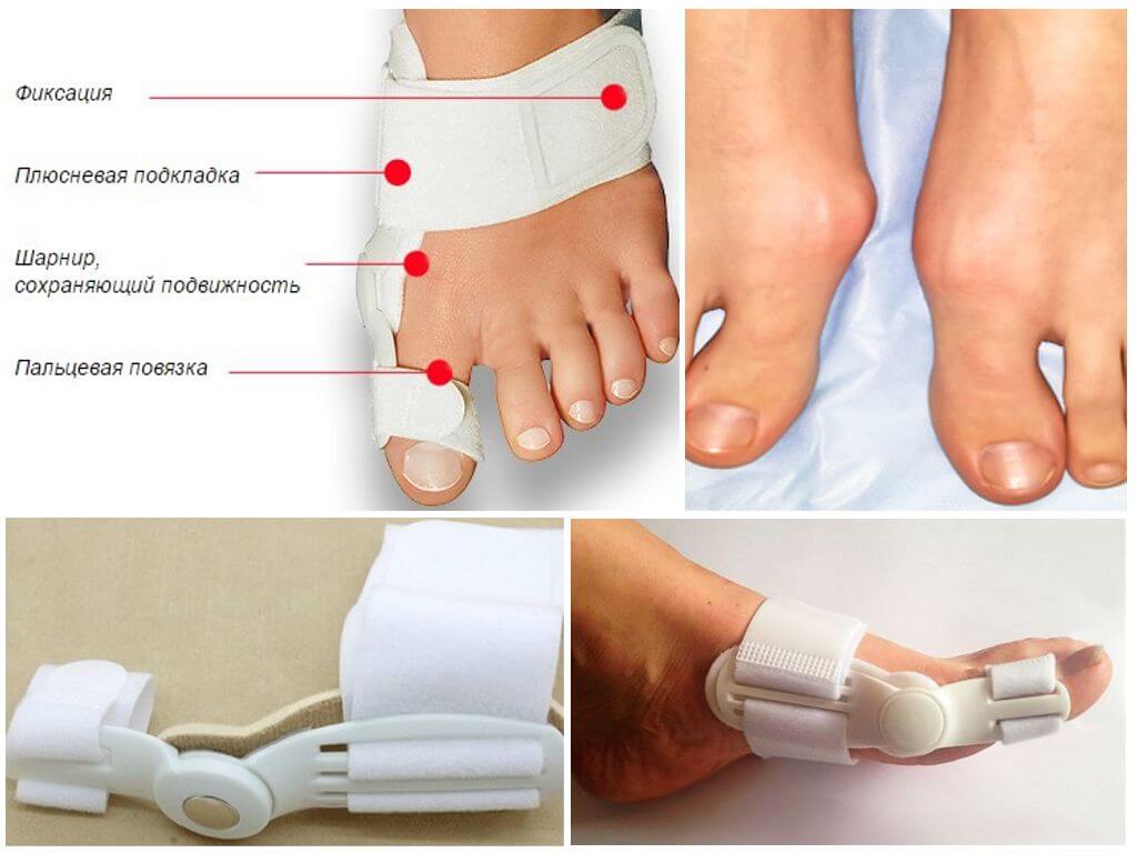 Вальгусная шина Valufix