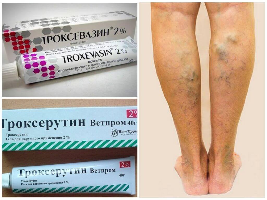 Аналоги средству от варикоза Варикобустер