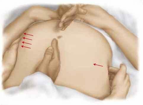 Определение асцита методом перкуссии