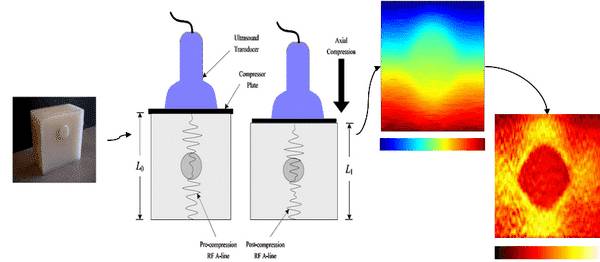 Методика компрессинной эластографии