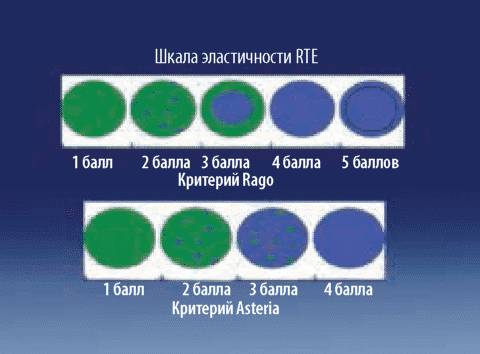 Оценка результатов эластографии по шкалам