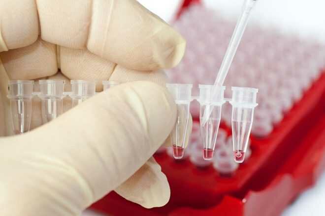 Для выявления заболевания и контроля лечению гепатита С нужно сдавать кровь на ПЦР
