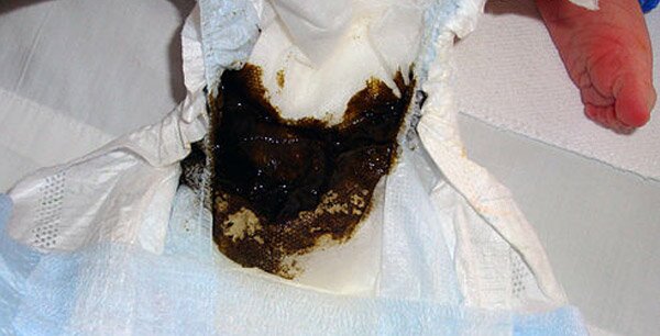 Фото мелены